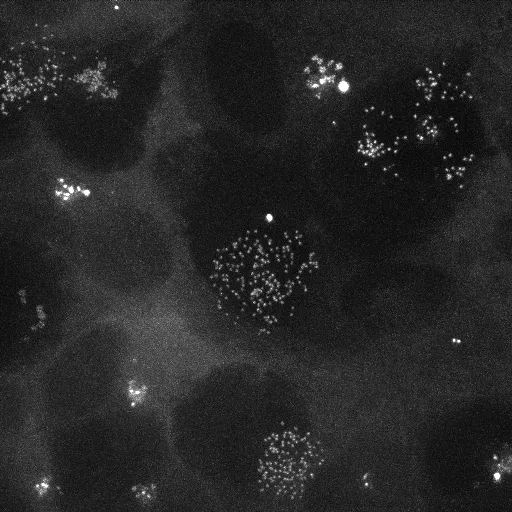 In collaboration with Alice Meunier, biologist.

Has the dispersion of information superseded human consciousness at the center of our evolution? 

Exploring this theory, i thought interesting to wonder which biological mechanism snap our choices and decisions process.

{Centriole} is a plunge into another dimension. A bottomless space where one travels between constellations of centrioles. Each cell is at a different stage of its metamorphosis. Some progress through a slow and barely visible process, while others have reached a quick, intense and explosive phase. 
Like the galaxies, some are contracting, others are expanding. 

By exploring the cell, we penetrate into our own mysteries. 

Biological generative art lives within us: centrioles are scattered, within the cell, surrounding the nucleus that shelters its DNA. Around a world, its world, our world. 

Reality is not interpreted, it is visualized: a collective motion brimming with distinction and dynamism. The centrioles flow like pixelated stars orchestrated in time and space. Their singularities arise. The invisible is unveiled, alive.

Spining disk videomicroscopy

A pixel is 2/10000 of millimeters in our brain.
One second represents 80mn of the cell dynamics

Sound by Agoria.
Film mp4 based on works by Alice Meunier, research director, IBENS, CNRS.