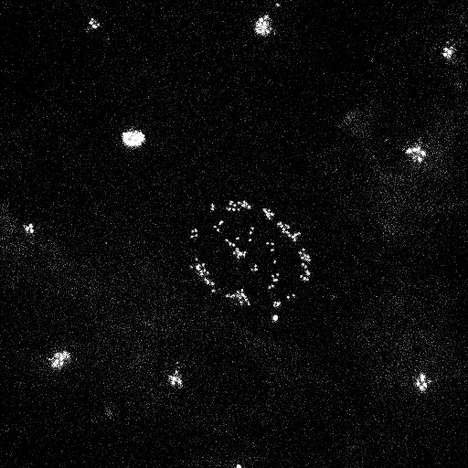 In collaboration with Alice Meunier, biologist. 

Has the dispersion of information superseded human consciousness at the center of our evolution? 

Exploring this theory, i thought interesting to wonder which biological mechanism snap our choices and decisions process. 

{Centriole} is a plunge into another dimension. A bottomless space where one travels between constellations of centrioles. Each cell is at a different stage of its metamorphosis. Some progress through a slow and barely visible process, while others have reached a quick, intense and explosive phase. Like the galaxies, some are contracting, others are expanding. 

By exploring the cell, we penetrate into our own mysteries.
Biological generative art lives within us: centrioles are scattered, within the cell, surrounding the nucleus that shelters its DNA. Around a world, its world, our world. Reality is not interpreted, it is visualized: a collective motion brimming with distinction and dynamism. The centrioles flow like pixelated stars orchestrated in time and space. Their singularities arise. The invisible is unveiled, alive. 

Spining disk videomicroscopy A pixel is 2/10000 of millimeters in our brain. One second represents 80mn of the cell dynamics Sound by Agoria. Film mp4 based on works by Alice Meunier, research director, IBENS, CNRS.