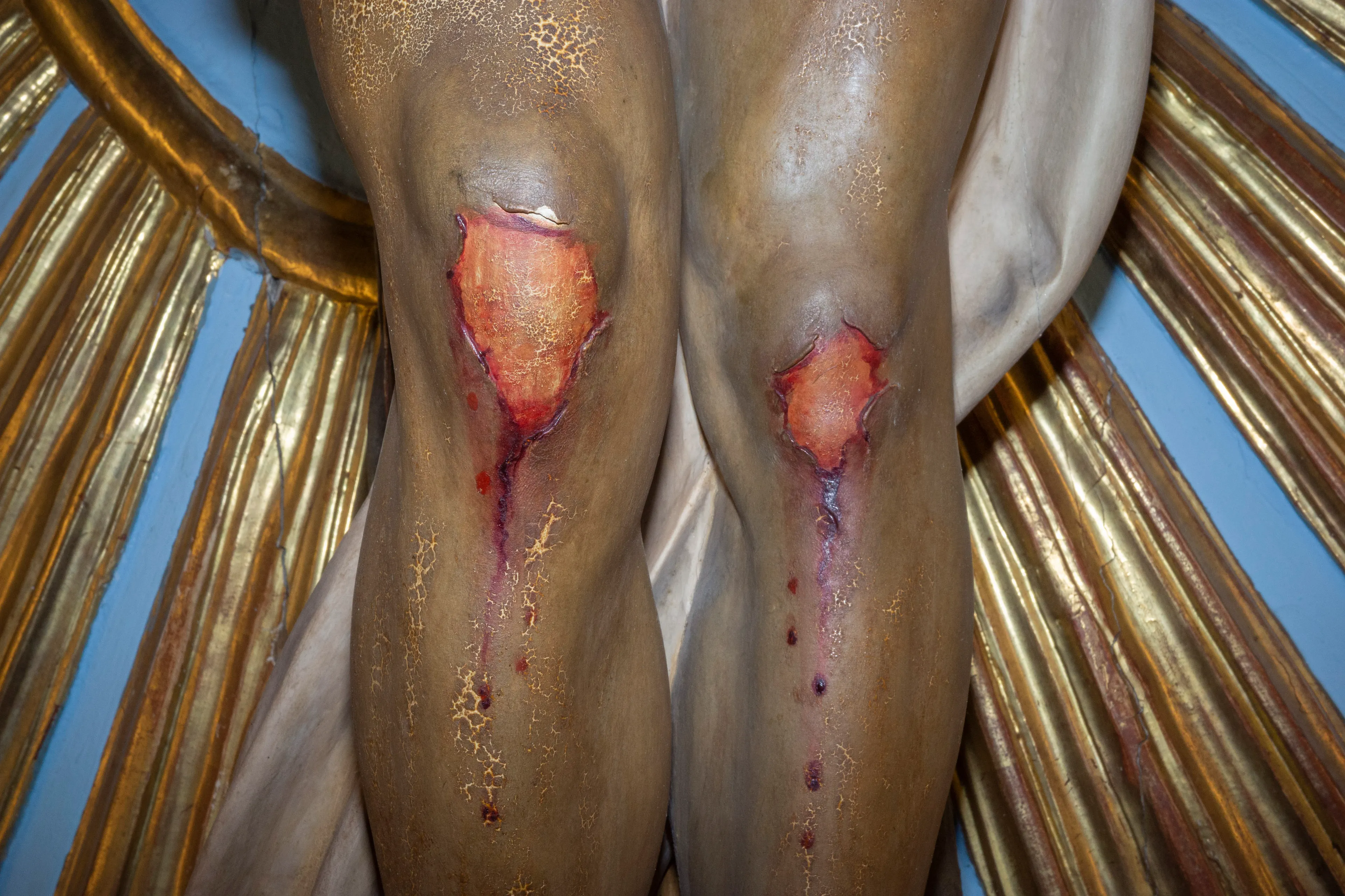 Scraped Knees on a sculpture