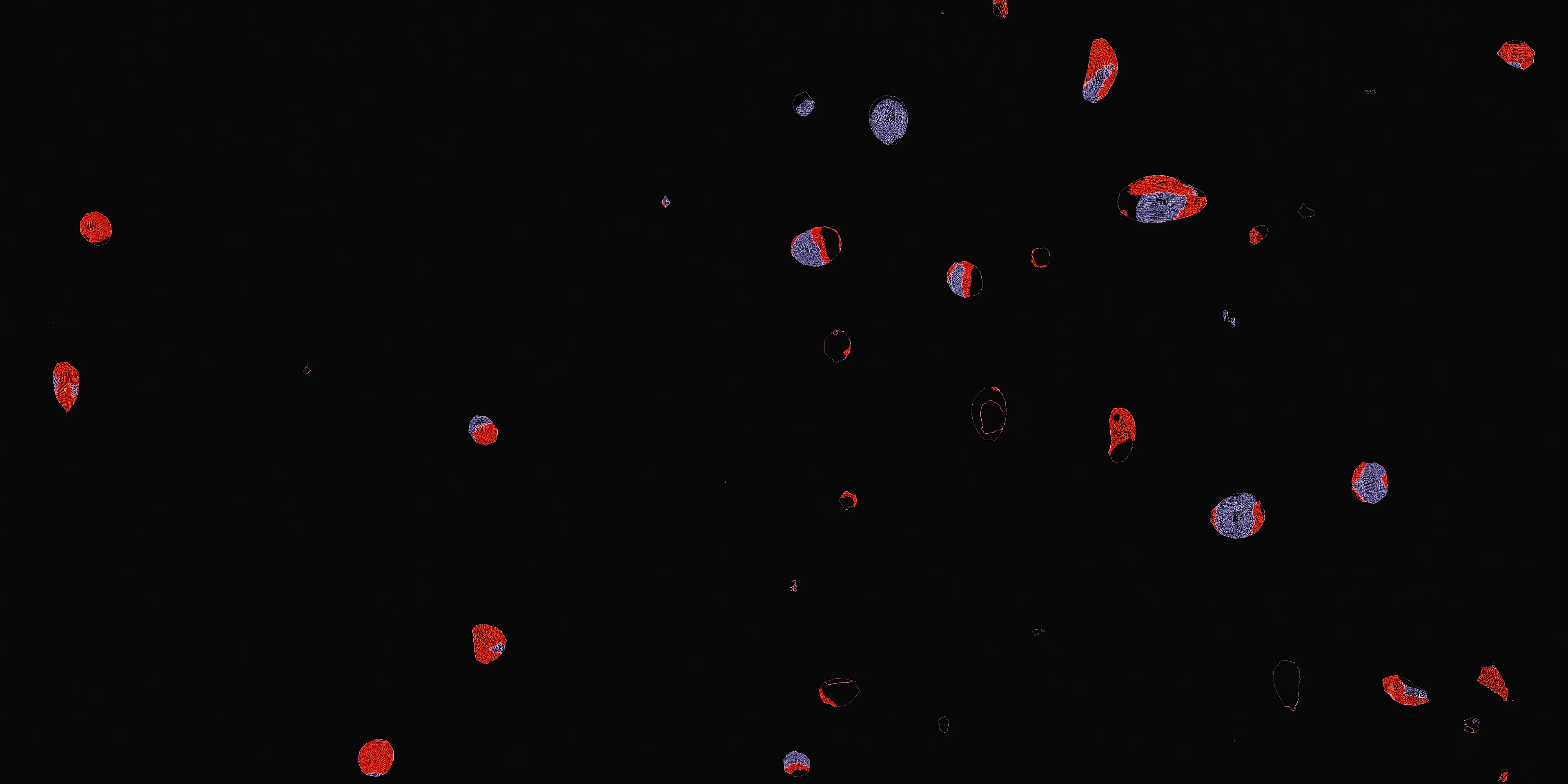 Have you ever seen a dancing worm?