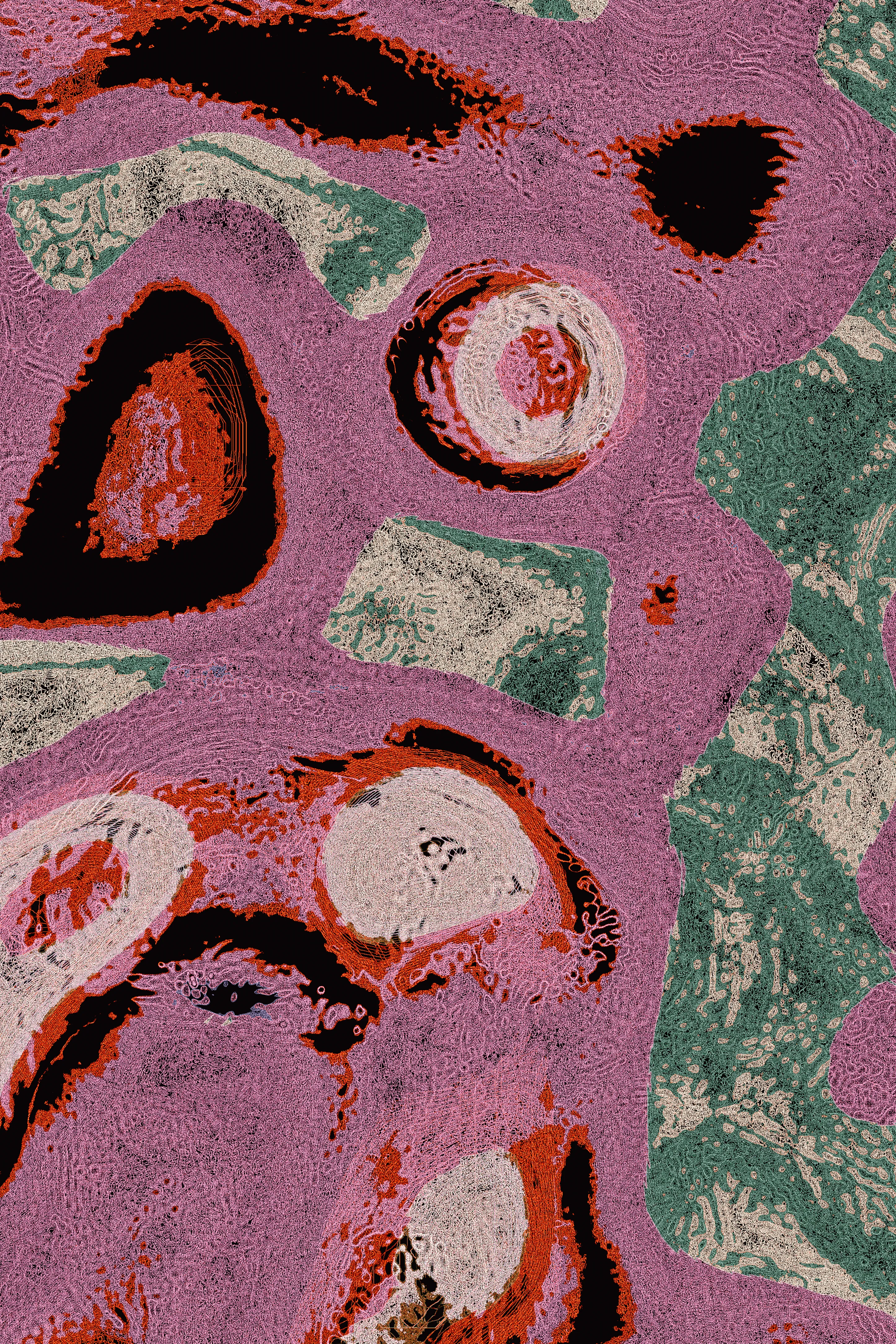 Have you ever seen a dancing worm?